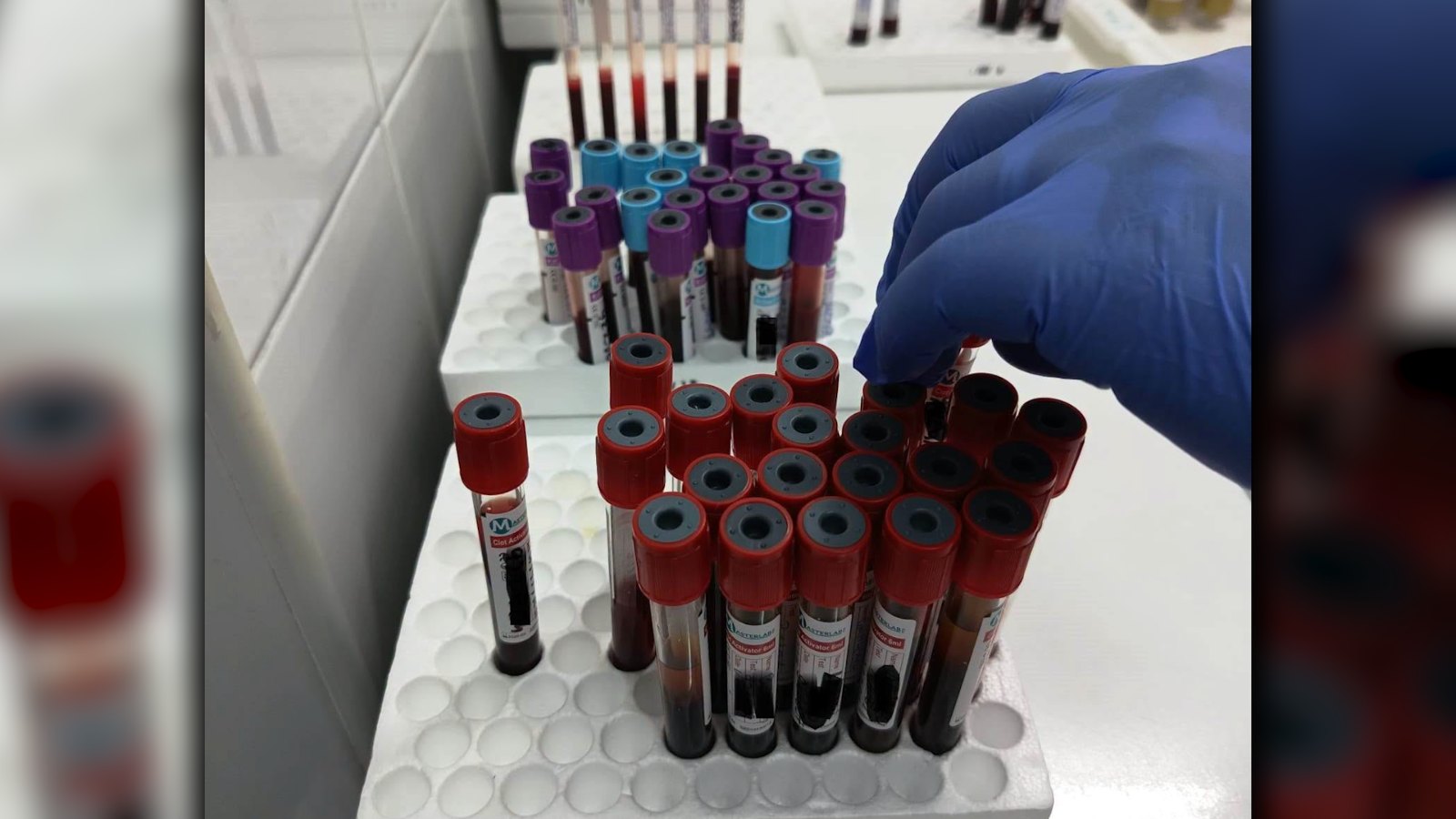 Analize medicale la SJU Târgu Jiu mai ieftine decât la privat